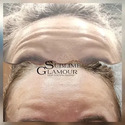 Kosmetolog i Trycholog Sublime Glamour Mgr Justyna Nimiro